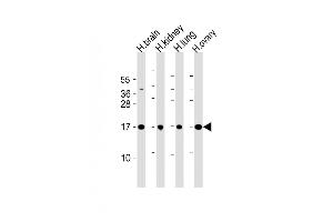 All lanes : Anti-IAL4A Antibody (Center) at 1:2000 dilution Lane 1: human brain lysate Lane 2: human kidney lysate Lane 3: human lung lysate Lane 4: human ovary lysate Lysates/proteins at 20 μg per lane. (PPIAL4A 抗体  (AA 66-92))