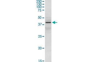 Western Blotting (WB) image for anti-serpin Peptidase Inhibitor, Clade A (Alpha-1 Antiproteinase, Antitrypsin), Member 3 (SERPINA3) (AA 1-423) antibody (ABIN513025)