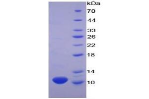 SDS-PAGE of Protein Standard from the Kit (Highly purified E. (CXCL7 ELISA 试剂盒)