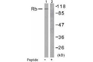 Image no. 2 for anti-Retinoblastoma 1 (RB1) (Ser807) antibody (ABIN197283) (Retinoblastoma 1 抗体  (Ser807))