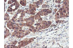 Image no. 3 for anti-phosphofructokinase, Platelet (PFKP) antibody (ABIN1500161) (PFKP 抗体)