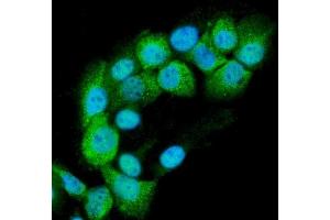 anti-RAB11B, Member RAS Oncogene Family (RAB11B) antibody