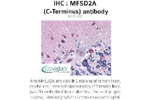 Image no. 1 for anti-Major Facilitator Superfamily Domain Containing 2A (MFSD2A) (C-Term) antibody (ABIN1736932)