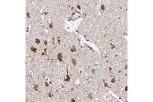 Immunohistochemical staining of human cerebral cortex with NF2 polyclonal antibody  shows strong cytoplasmic positivity in neuronal cells at 1:200-1:500 dilution.