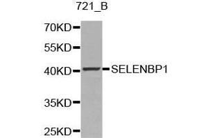 Western blot analysis of 721_B cell lysate using SELENBP1 antibody. (SELENBP1 抗体  (AA 243-472))