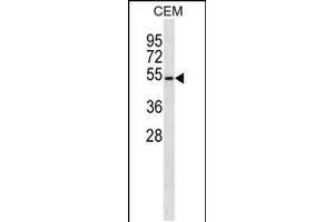 Western blot analysis in CEM cell line lysates (35ug/lane). (B4GALT4 抗体  (AA 91-117))