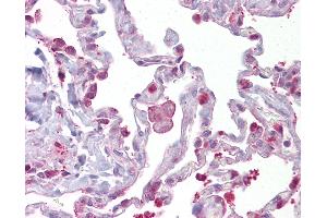 Immunohistochemistry (IHC) image for anti-Hematopoietic Prostaglandin D Synthase (HPGDS) (AA 35-84) antibody (ABIN958991)