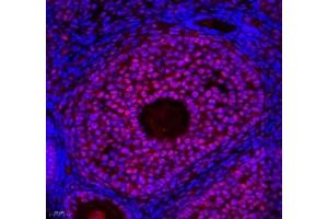 Immunofluorescence of paraffin embedded mouse ovary using ZC3H11A (ABIN7076255) at dilution of 1: 650 (400x lens) (ZC3H11A 抗体)