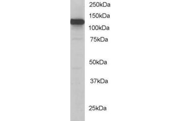 KIF5B 抗体  (C-Term)