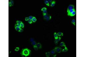 Immunofluorescence staining of PC-3 cells with ABIN7153483 at 1:33, counter-stained with DAPI. (GABRA4 抗体  (AA 36-258))