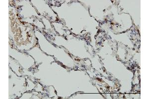 Immunostaining (ISt) image for anti-Coronin, Actin Binding Protein, 1A (CORO1A) (AA 360-461) antibody (ABIN564843)