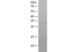 NAIF1 Protein (AA 1-327) (His tag)