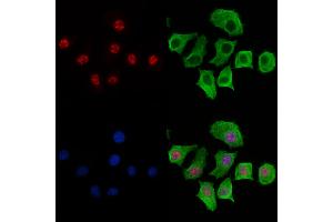 ABIN6266074 and ABIN6269267 staining HepG2 cells by IF/ICC. (YAP1 抗体  (Internal Region))