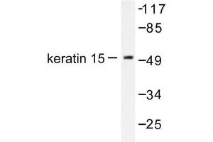 Image no. 1 for anti-Keratin 15 (KRT15) antibody (ABIN265494) (KRT15 抗体)