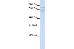 EDEM1 antibody used at 1 ug/ml to detect target protein. (EDEM1 抗体  (N-Term))
