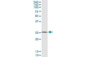 Immunoprecipitation of FXN transfected lysate using anti-FXN monoclonal antibody and Protein A Magnetic Bead , and immunoblotted with FXN MaxPab rabbit polyclonal antibody. (Frataxin 抗体  (AA 91-200))