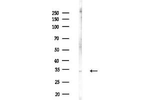 anti-Neutrophil Cytosolic Factor 4, 40kDa (NCF4) (C-Term) antibody