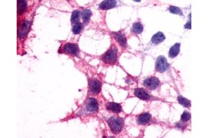 Anti-P2RY12 / P2Y12 antibody immunocytochemistry (ICC) staining of HEK293 human embryonic kidney cells transfected with P2RY12 / P2Y12. (P2RY12 抗体  (N-Term))
