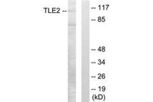 Western blot analysis of extracts from LOVO cells, using TLE2 Antibody. (TLE2 抗体  (AA 211-260))