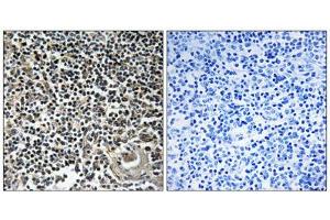 Immunohistochemistry analysis of paraffin-embedded human thymus gland tissue using CBLN4 antibody. (CBLN4 抗体  (C-Term))