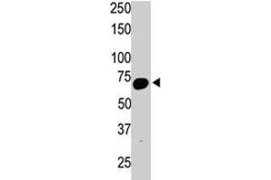 The SYVN1 polyclonal antibody  is used in Western blot to detect SYVN1 in mouse kidney tissue lysate. (SYVN1 抗体  (C-Term))