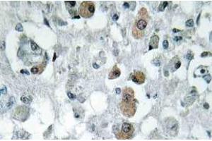 Immunohistochemistry (IHC) analyzes of GNPAT antibody in paraffin-embedded human brain tissue. (GNPAT 抗体)