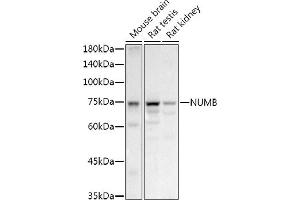 Western blot analysis of extracts of various cell lines, using NUMB antibody (ABIN6129424, ABIN6144943, ABIN6144944 and ABIN6224990) at 1:1000 dilution. (NUMB 抗体  (AA 521-640))
