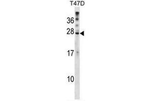 Western blot analysis in T47D cell line lysates (35µg/lane) using RNF4 Antibody (C-term) Cat. (RNF4 抗体  (C-Term))