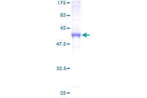 PSMA3 Protein (AA 1-248) (GST tag)