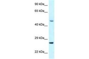 Image no. 1 for anti-Cyclin-Dependent Kinase 20 (CDK20) (N-Term) antibody (ABIN6747693) (CCRK 抗体  (N-Term))