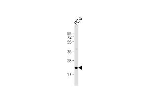 Anti-OBEC3C Antibody (C-Term) at 1:2000 dilution + PC-3 whole cell lysate Lysates/proteins at 20 μg per lane. (APOBEC3C 抗体  (AA 143-177))