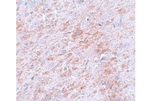 Immunohistochemical staining of rat brain tissue with DCLK2 polyclonal antibody  at 5 ug/mL dilution. (DCLK2 抗体  (C-Term))