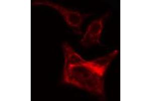 ABIN6266643 staining Hela cells by IF/ICC. (TGFA 抗体)