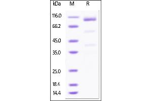 SDS-PAGE (SDS) image for Glypican 3 (GPC3) (AA 25-559) (Active) protein (Fc Tag) (ABIN4949101)