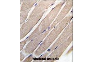 Forlin-fixed and paraffin-embedded hun skeletal muscle tissue reacted with P2K4 Antibody  (ABIN392418 and ABIN2842027) , which was peroxidase-conjugated to the secondary antibody, followed by DAB staining. (MAP2K4 抗体  (AA 235-264))