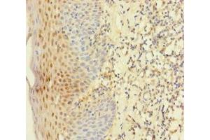 Immunohistochemistry of paraffin-embedded human tonsil tissue using ABIN7145011 at dilution of 1:100 (YME1L1 抗体  (AA 1-240))