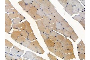 anti-Adiponectin Receptor 2 (ADIPOR2) (N-Term) antibody
