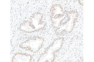 Immunohistochemistry (IHC) image for anti-Exportin 1 (XPO1) (C-Term) antibody (ABIN7453427) (XPO1 抗体  (C-Term))