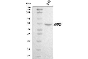 Western blot analysis of MMP13 using anti-MMP13 antibody (ABIN7600880).