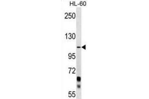 Western Blotting (WB) image for anti-Protocadherin alpha 10 (PCDHA10) antibody (ABIN2999486) (PCDHA10 抗体)