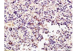 Formalin-fixed and paraffin embedded mouse embryo tissue labeled with Rabbit Anti-ERK1 (Thr203/Tyr205) + ERK2 (Thr183/Tyr185) Polyclonal Antibody, Unconjugated  at 1:200 followed by conjugation to the secondary antibody and DAB staining (ERK1/2 抗体  (pThr183, pTyr185))