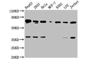 Western Blot Positive WB detected in: HepG2 whole cell lysate, 293T whole cell lysate, Hela whole cell lysate, MCF-7 whole cell lysate, K562 whole cell lysate, LO2 whole cell lysate, Jurkat whole cell lysate All lanes: UBC antibody at 1:2000 Secondary Goat polyclonal to rabbit IgG at 1/50000 dilution Predicted band size: 78 kDa Observed band size: 78 kDa (UBC 抗体  (AA 19-36))