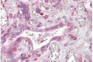 Anti-NFATC4 antibody IHC staining of human placenta. (NFATC4 抗体  (AA 953-965))
