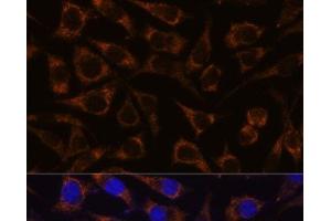 Immunofluorescence analysis of L929 cells using GTPBP8 Polyclonal Antibody at dilution of 1:100. (GTPBP8 抗体)
