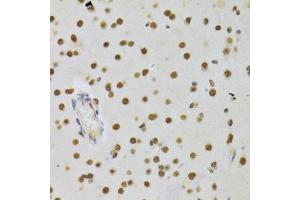 Immunohistochemistry of paraffin-embedded rat brain using DNMT3A Antibody (ABIN1872325) at dilution of 1:100 (40x lens). (DNMT3A 抗体)
