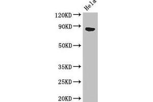 Western Blot Positive WB detected in: Hela whole cell lysate All lanes: APEH antibody at 3 μg/mL Secondary Goat polyclonal to rabbit IgG at 1/50000 dilution Predicted band size: 82 kDa Observed band size: 82 kDa (APEH 抗体  (AA 201-500))