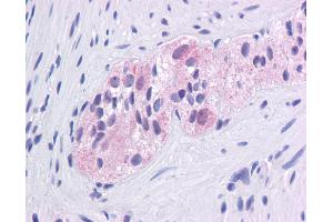 Immunohistochemistry with Colon, myenteric plexus tissue at an antibody concentration of 5. (EGR1 抗体  (N-Term))