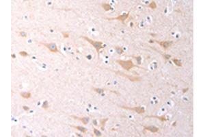The image on the left is immunohistochemistry of paraffin-embedded Human brain tissue using ABIN7130977(SCGB1A1 Antibody) at dilution 1/60, on the right is treated with fusion protein.
