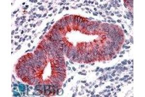 AP22445PU-N VPS29 antibody staining of paraffin embedded Human Uterus at 3. (VPS29 抗体  (Internal Region))