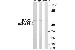 Western blot analysis of extracts from HepG2 cells treated with Adriamycin (0. (PAK2 抗体  (pSer141))